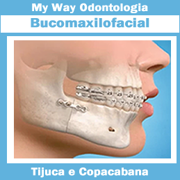 My Way Odontologia. Especialidade: Bucomaxilofacial